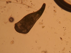 Stentor amethystinus