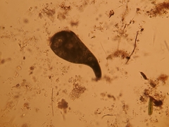 Stentor amethystinus