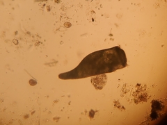 Stentor amethystinus