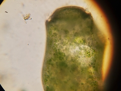 Stentor amethystinus