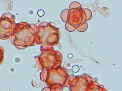 Hypomyces stephanomatis