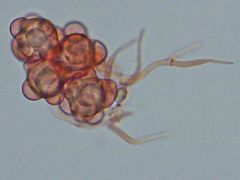 Hypomyces stephanomatis