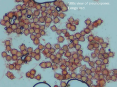 Hypomyces stephanomatis