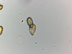Melampsoridium hiratsukanum
