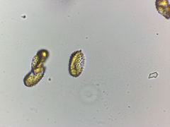 Melampsoridium hiratsukanum