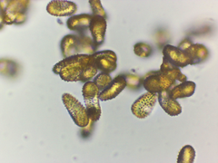 Melampsoridium hiratsukanum