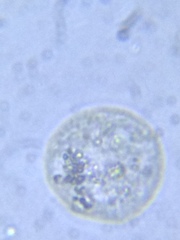 Sphaerocystis