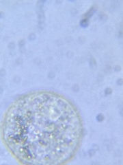 Sphaerocystis