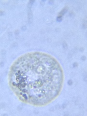 Sphaerocystis