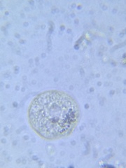 Sphaerocystis