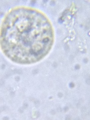 Sphaerocystis