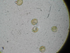 Trichia botrytis