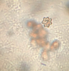 Sarcodon atroviridis