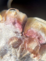 Fusarium graminearum