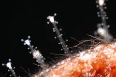 Zanclea