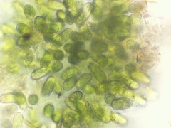 Dolichospermum lemmermannii