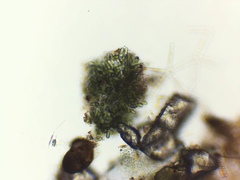 Dolichospermum lemmermannii