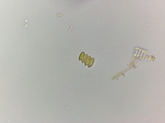 Scenedesmus