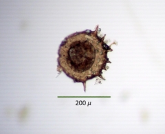 Centropyxis discoides