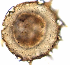 Centropyxis discoides