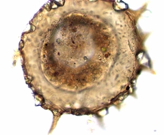 Centropyxis discoides