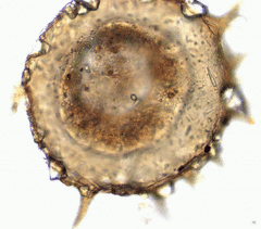 Centropyxis discoides