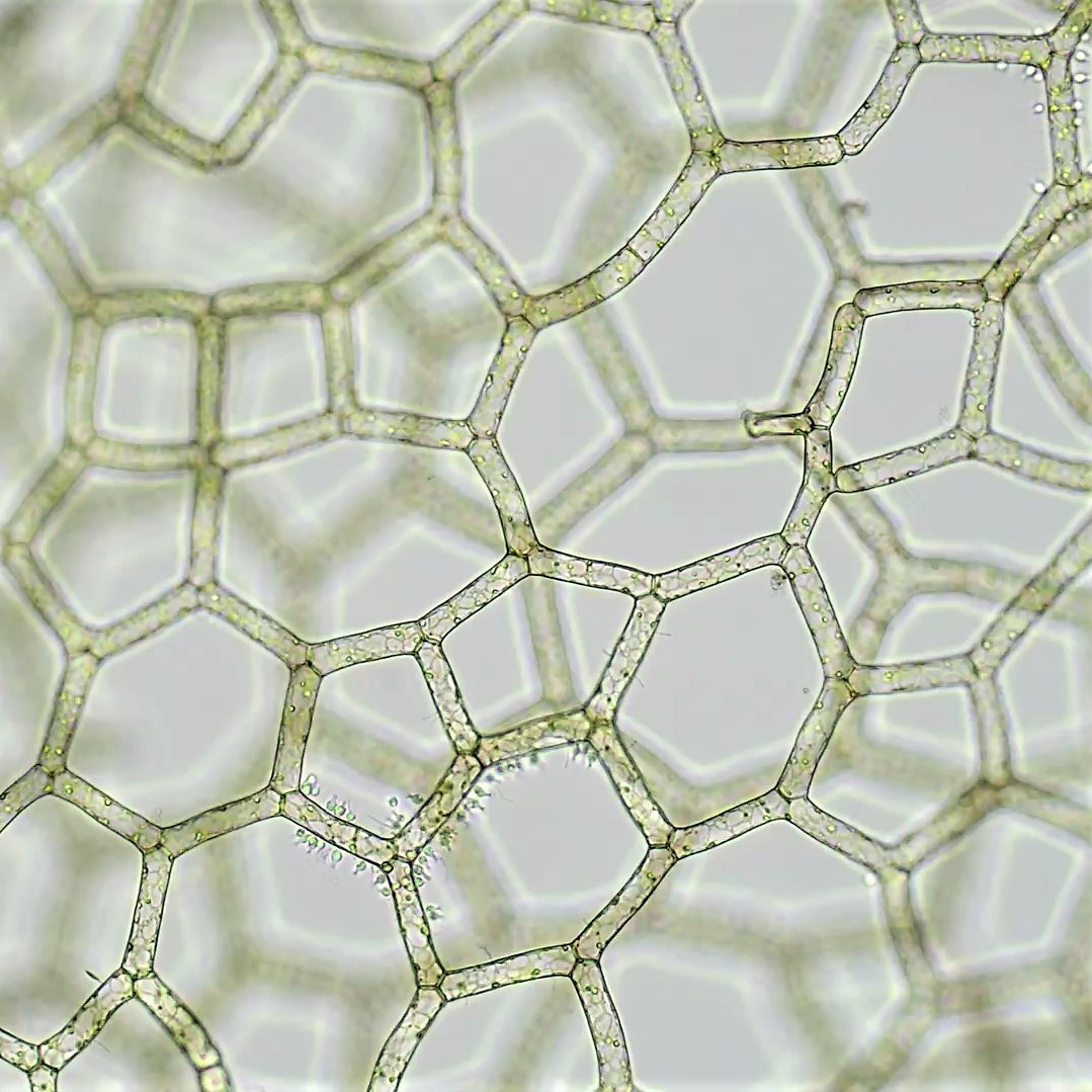 Hydrodictyon