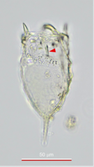 Keratella cochlearis