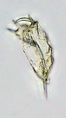 Keratella cochlearis