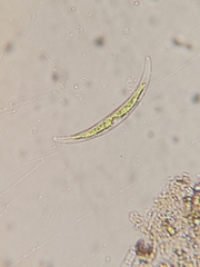 Closterium parvulum