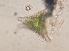 Staurastrum oxyacanthum