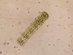 Hyalotheca