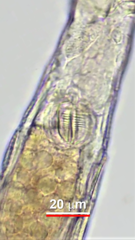 Otostephanos donneri