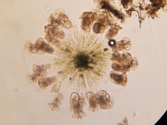 Conochilus hippocrepis