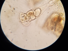 Conochilus hippocrepis