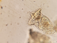 Conochilus hippocrepis