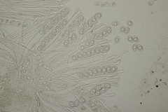 Trichophaea woolhopeia