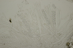 Trichophaea woolhopeia