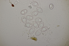 Trichophaea woolhopeia