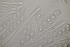 Trichophaea woolhopeia