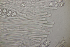 Trichophaea woolhopeia