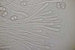 Trichophaea woolhopeia