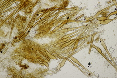 Trichophaea woolhopeia