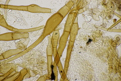 Trichophaea woolhopeia