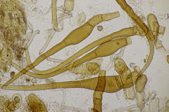 Trichophaea woolhopeia