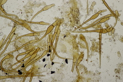 Trichophaea woolhopeia