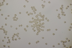 Tomentella ferruginea