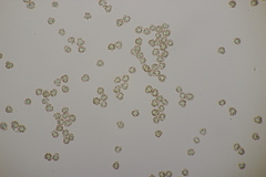 Tomentella ferruginea