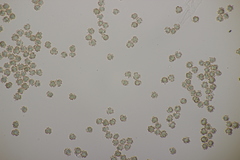 Tomentella ferruginea