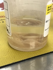 Spirometra mansonoides